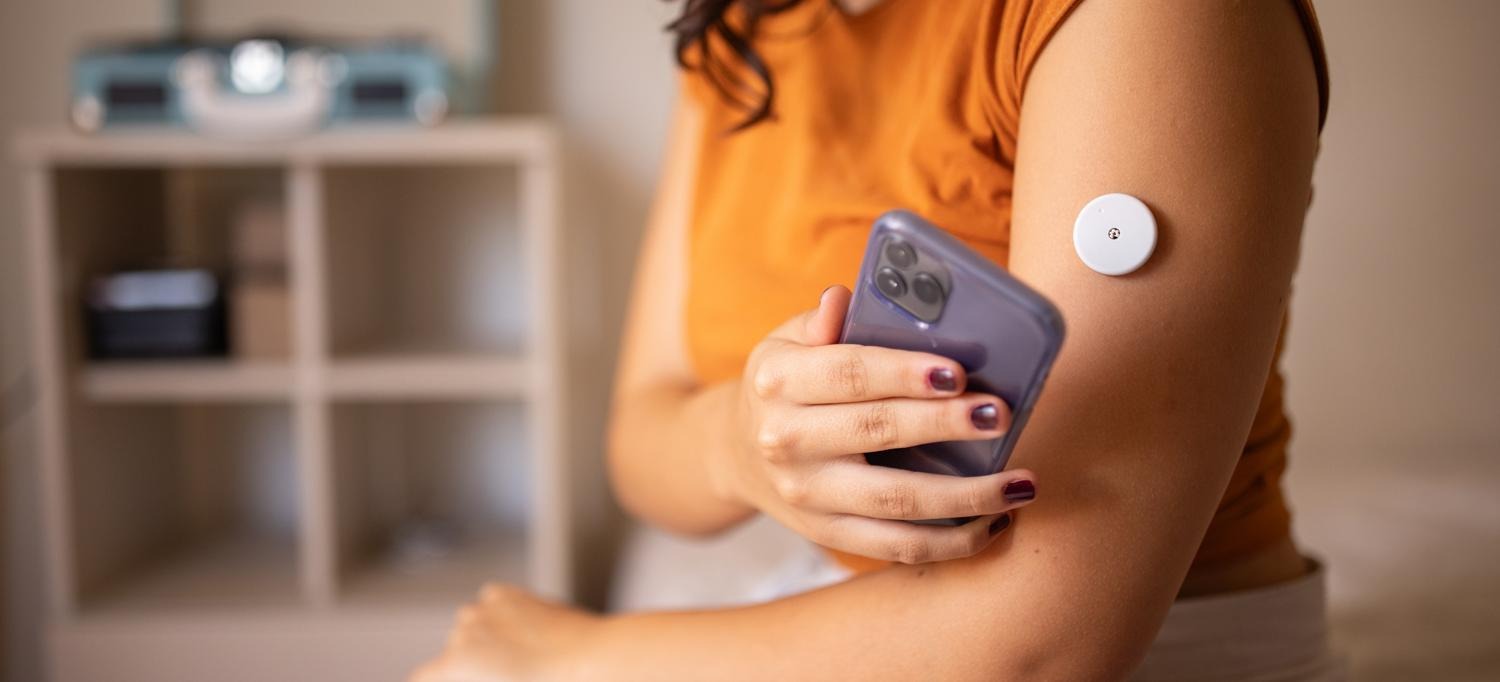 Monitores Continuos De Glucosa: ¿Moda O Herramienta Útil?